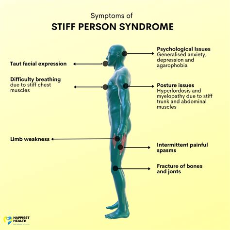 stiff person syndrom lebenslauf